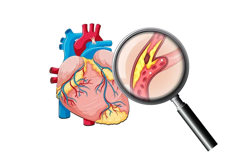 Common Heart Conditions